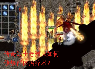 传奇战士老烈火如何修炼群体治疗术? 传奇战士老烈火如何修炼群体治疗术?